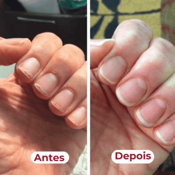 Fortaleça suas unhas (antes/depois)