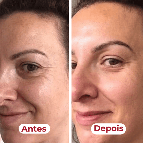 Revitalize sua pele (antes/depois)