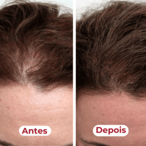 Estimule o crescimento (antes/depois)